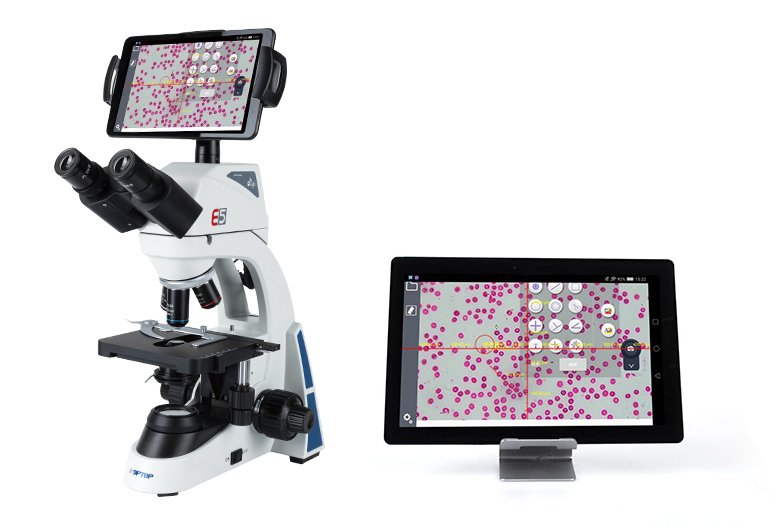 Microscopio E5 de Sunny Optical Technology con la imagen en tabletas por WiFi